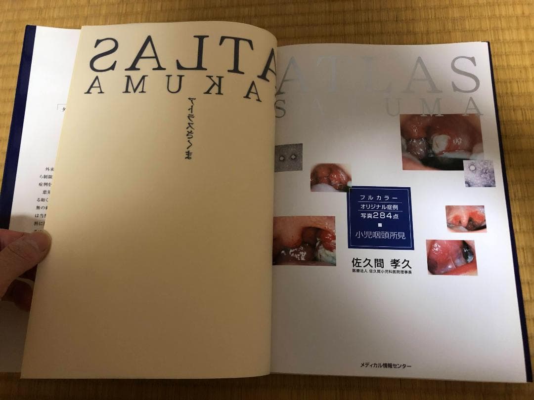 アトラスさくま : 小児咽頭所見 フルカラーオリジナル症例写真284点