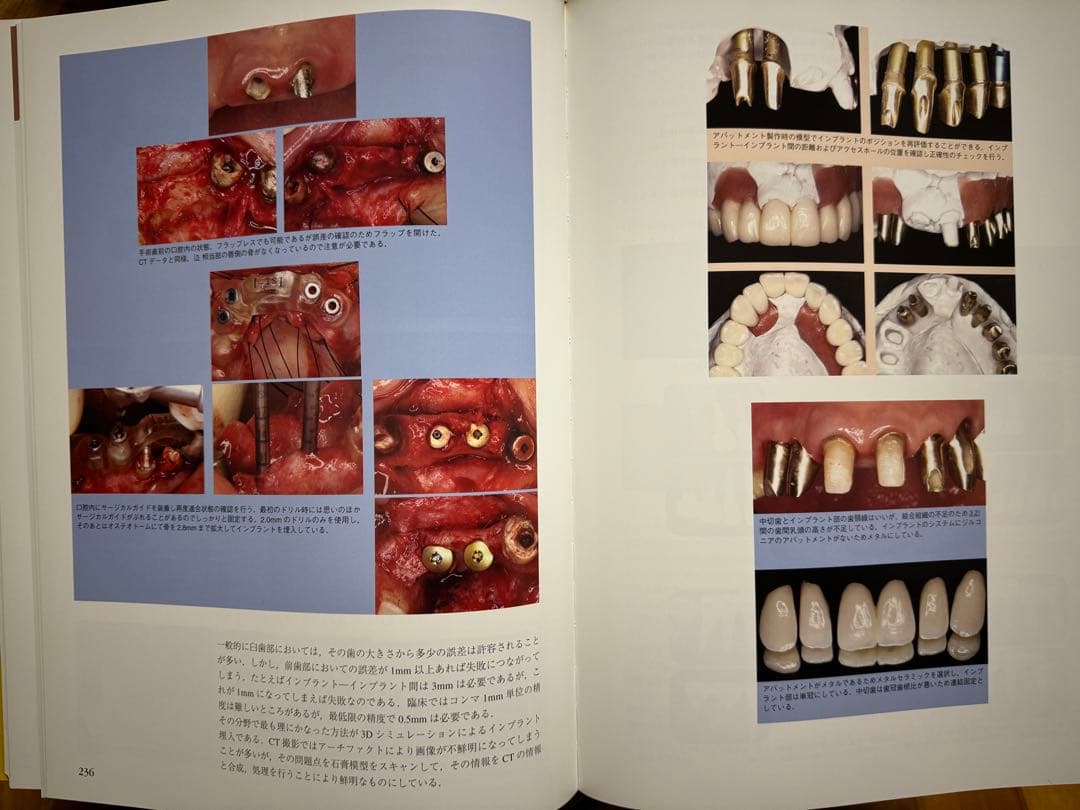 成功に導く治療計画と臨床基準