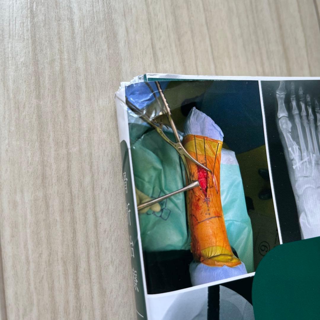 【裁断済み】骨折治療 手術アプローチがよくわかる髄内釘・プレート固定