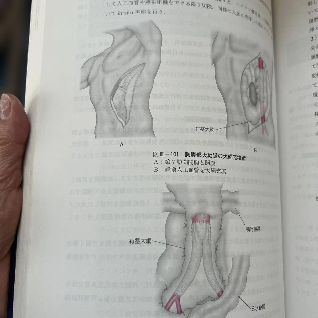 血管外科基本手技アトラス