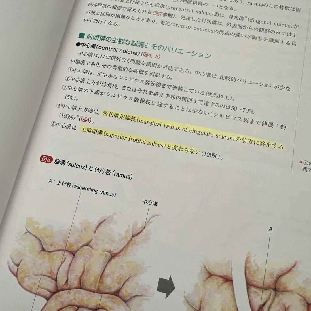 ビジュアル脳神経外科 1 前頭葉・頭頂葉