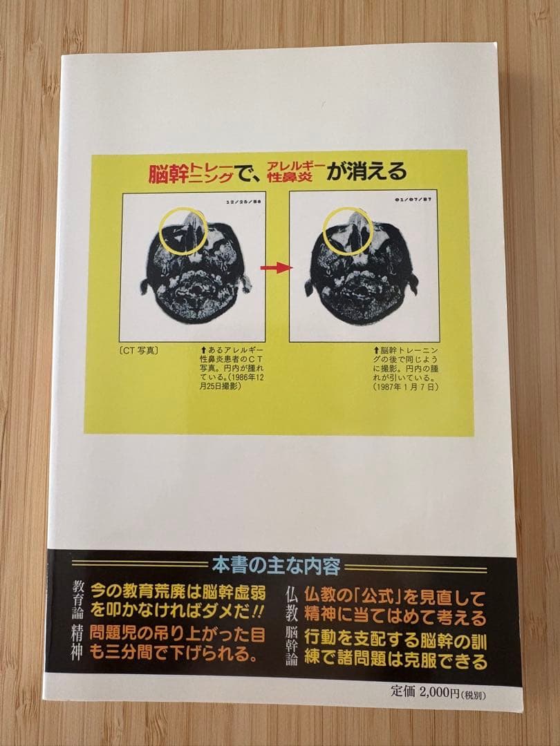 敵は脳幹にあり　戸塚宏著