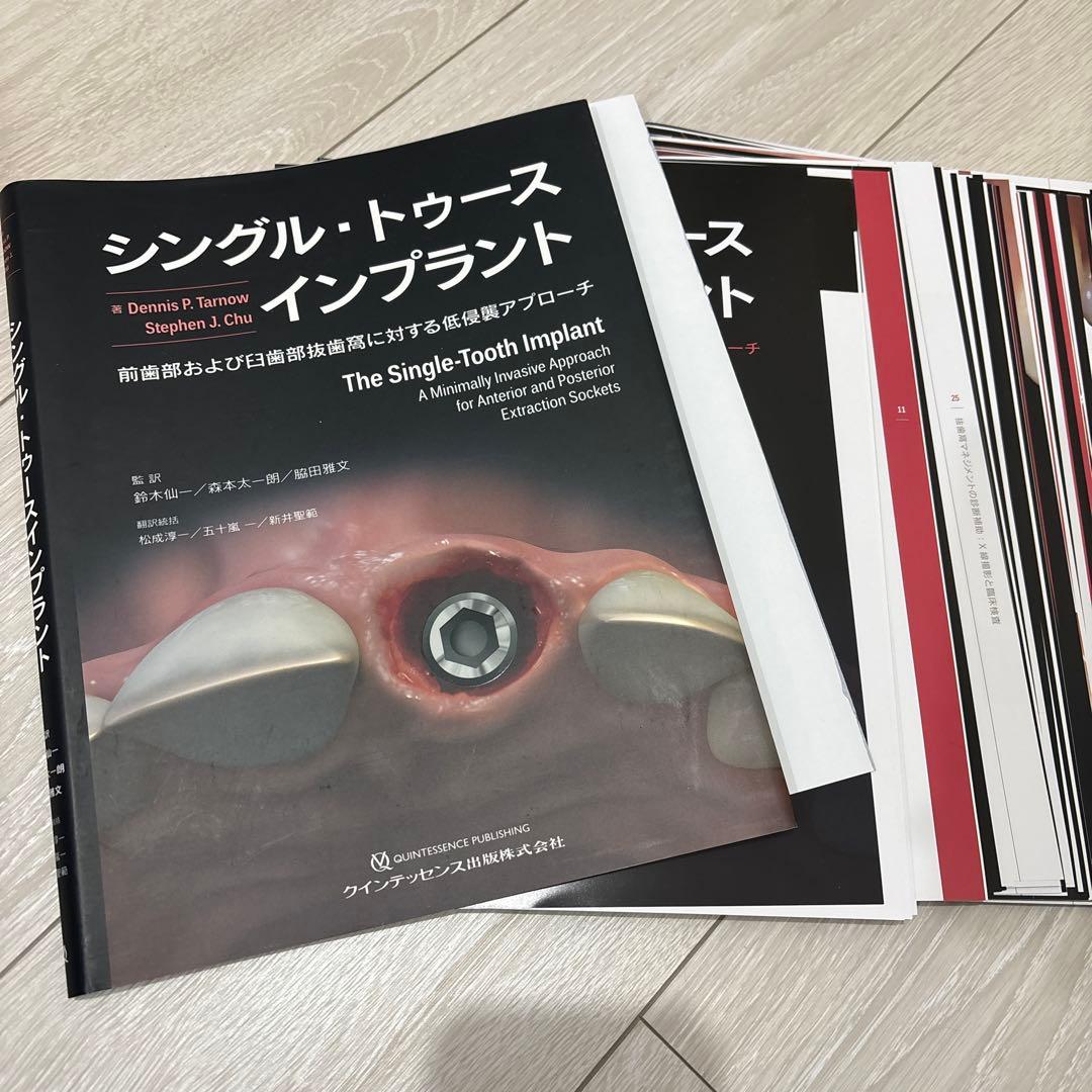 歯科　シングル・トゥース インプラント　裁断済み