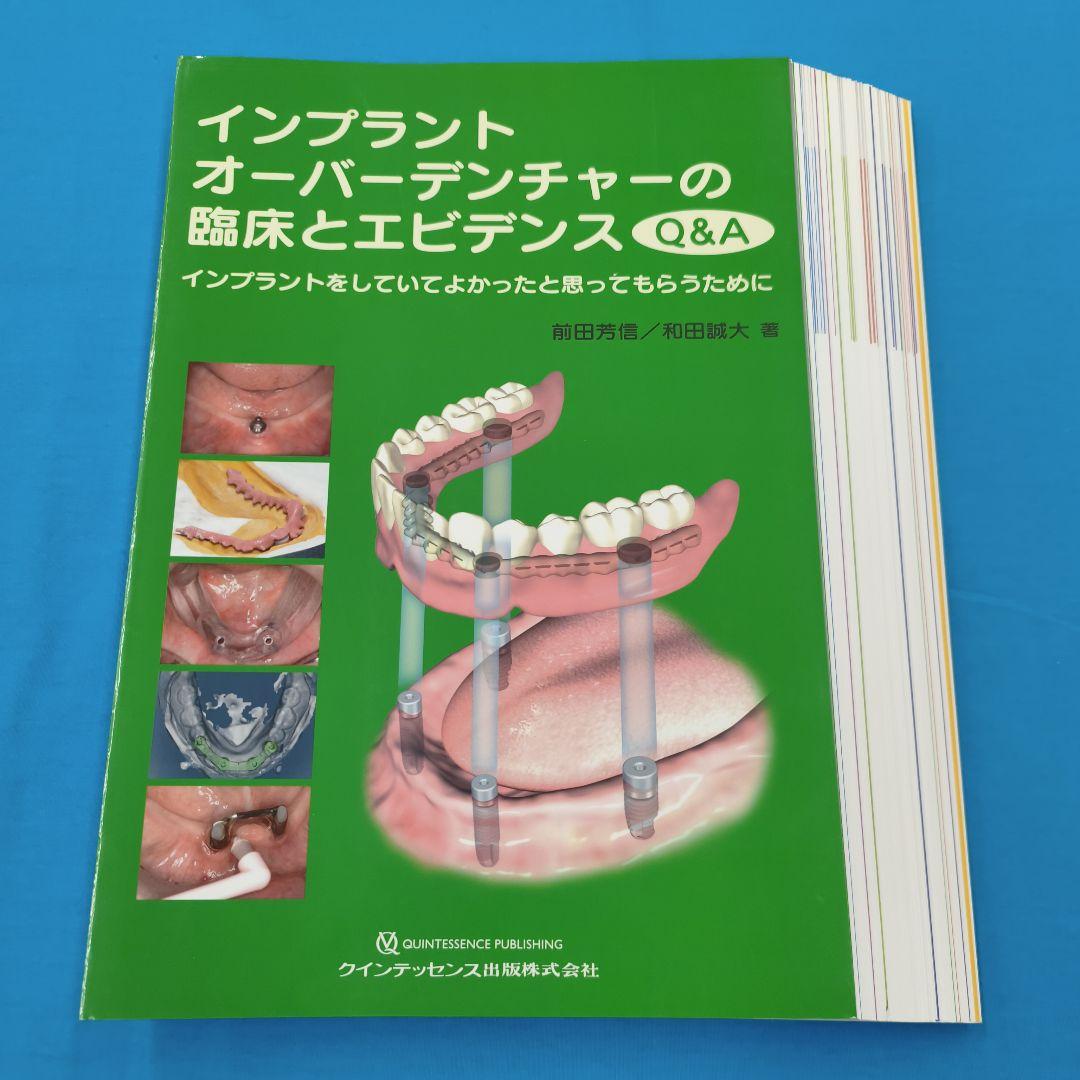 ☆裁断済 インプラントオーバーデンチャーの臨床とエビデンス Q&A