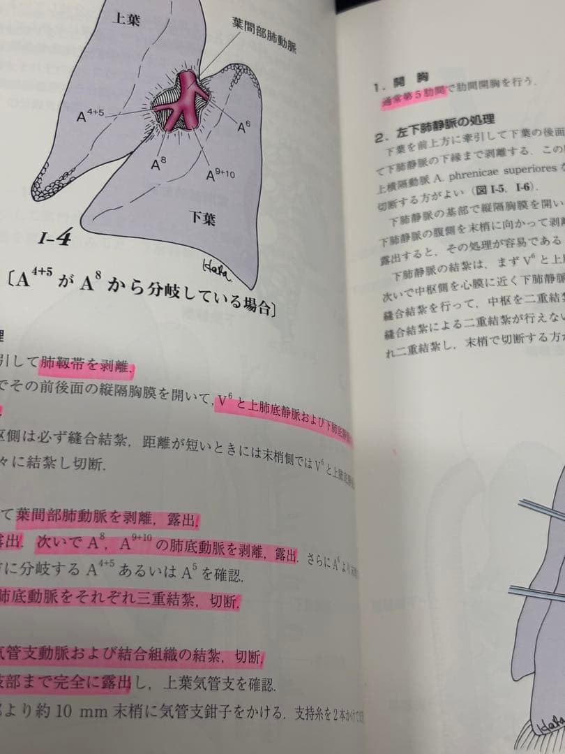 呼吸器外科手術書　第6版