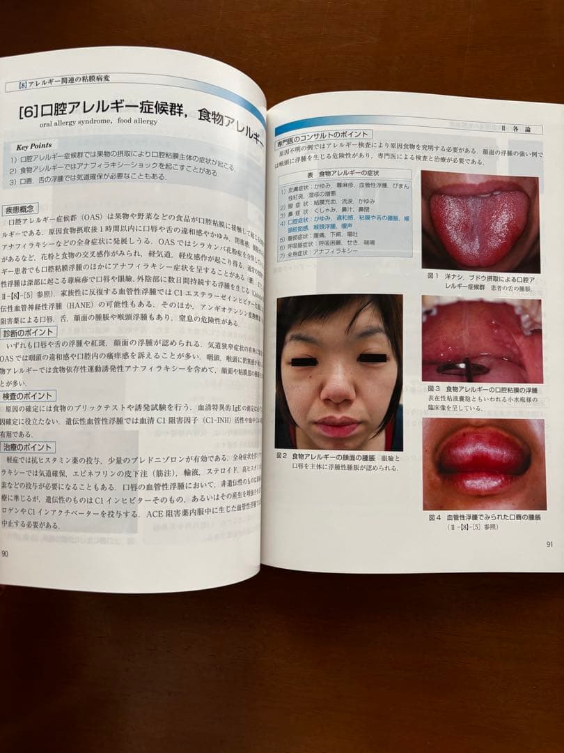 日常診療に役立つ　全身疾患関連の口腔粘膜病変アトラス