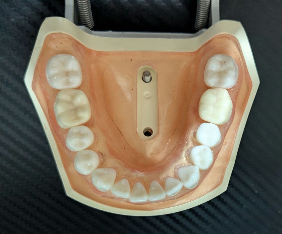 ニッシン　顎模型 複製歯牙着脱模型　実習用 舌、スタンド付き