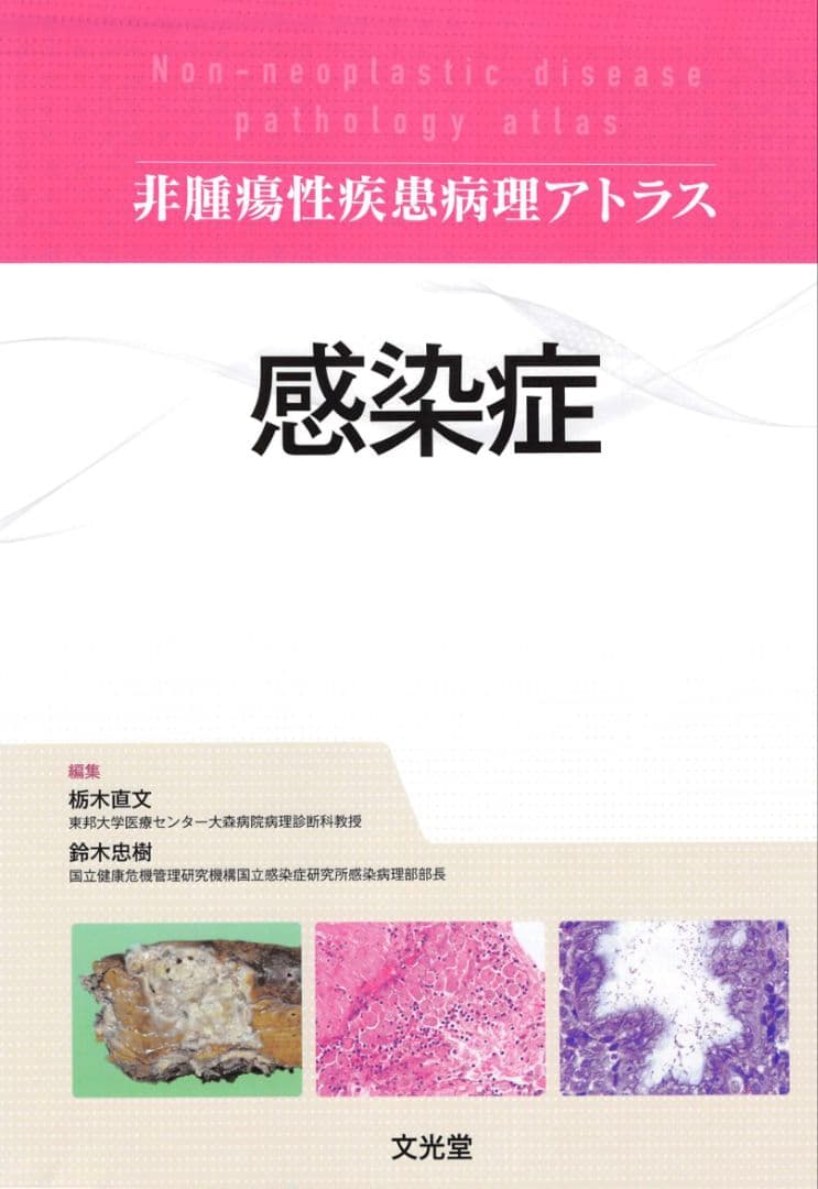非腫瘍性疾患病理アトラス 感染症 裁断済み