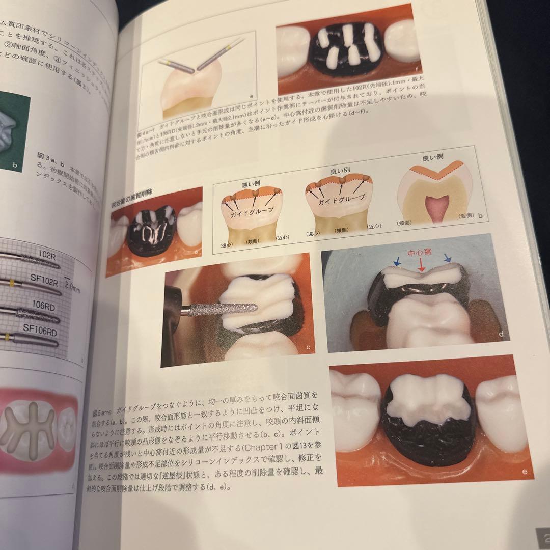 必ず上達 デジタル時代の歯冠修復　最終値下げ