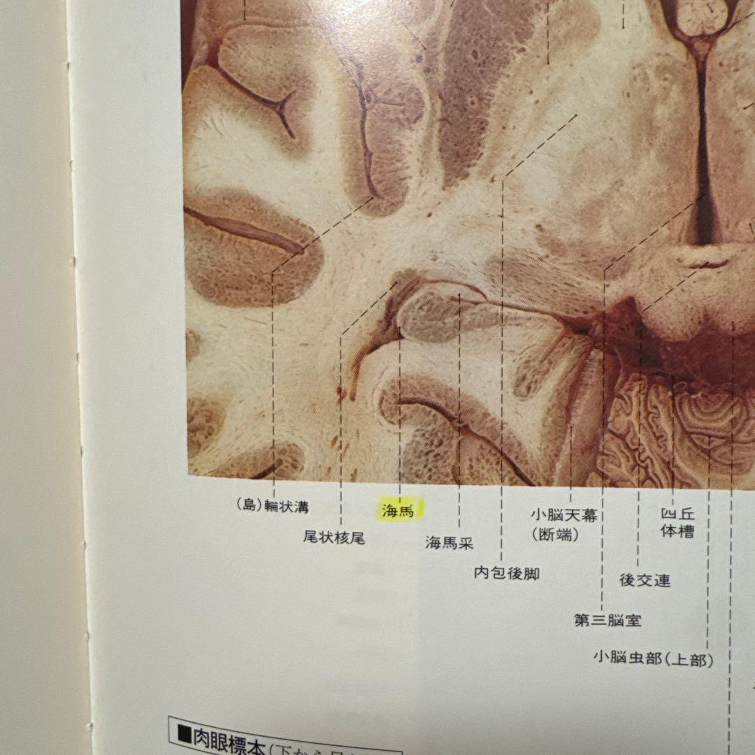 MRI、CT診断のための頭部脊椎解剖カラーアトラス 原書第2版 半田讓二訳