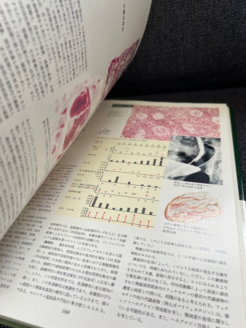 医学図譜集 腎臓編【Frank H. Netter 解剖学専門書 医学イラスト本