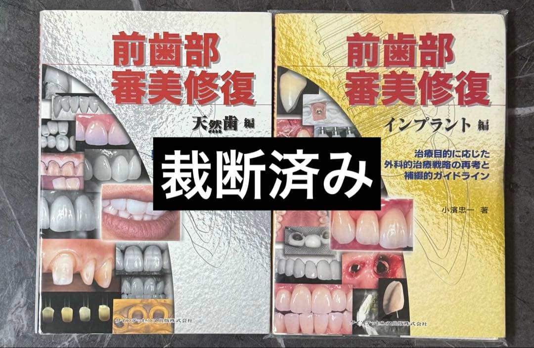 前歯部審美修復