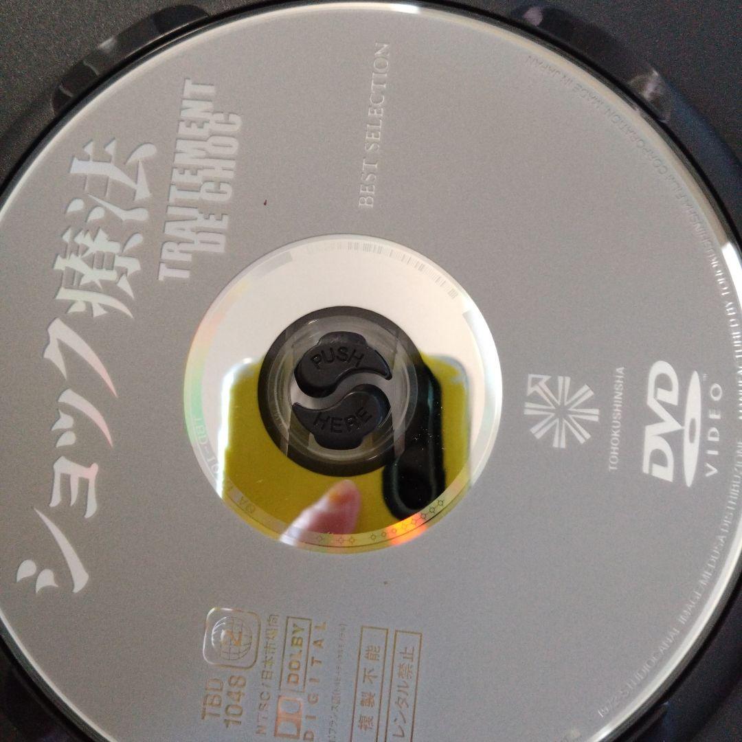 アラン・ドロン　ショック療法　DVD