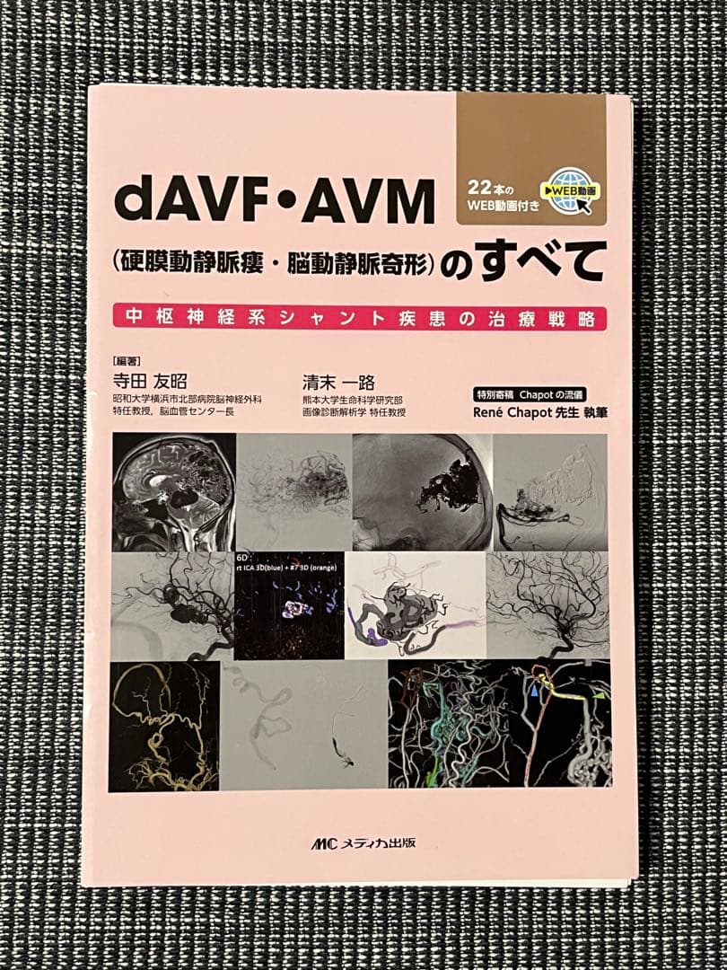 【裁断済み】dAVF・AVM(硬膜動静脈瘻・脳動静脈奇形)のすべて