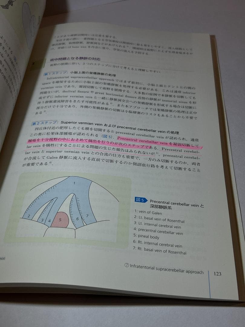 脳静脈エッセンス: 脳静脈の歩き方 単行本 – 2016/10/17