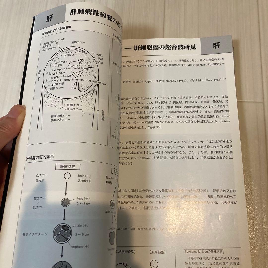 腹部超音波テキスト 上・下腹部　改訂第3版　超音波検査士　ベクトルコア　医学書
