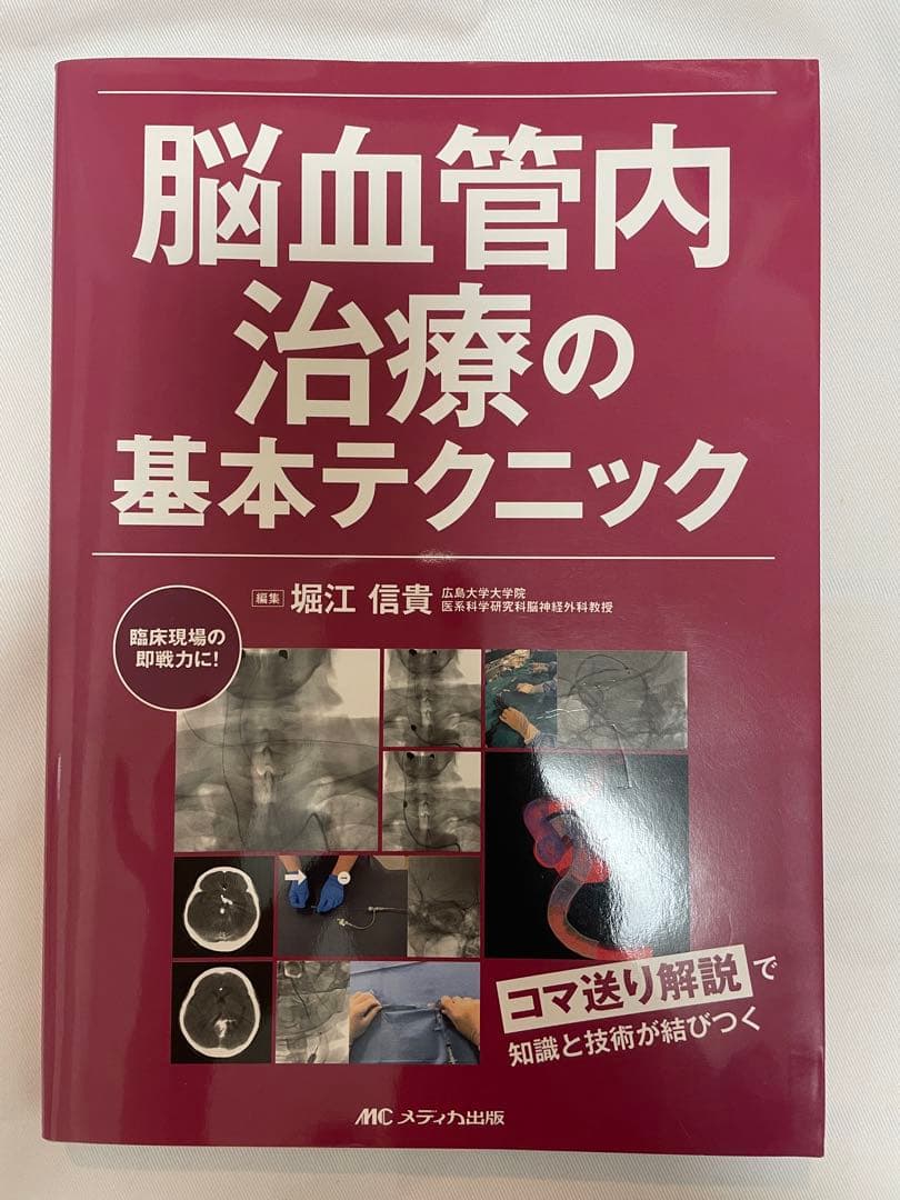 【新品】脳血管内治療の基本テクニック