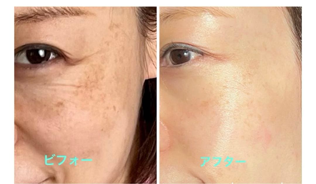 プリマトリーチェ　CO2ジェルパック　世界一の炭酸パック　10包入