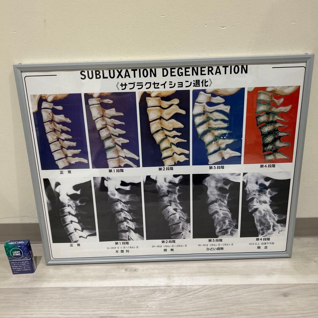 【レア】サブラクセーションパネル　カイロプラクティック/整体