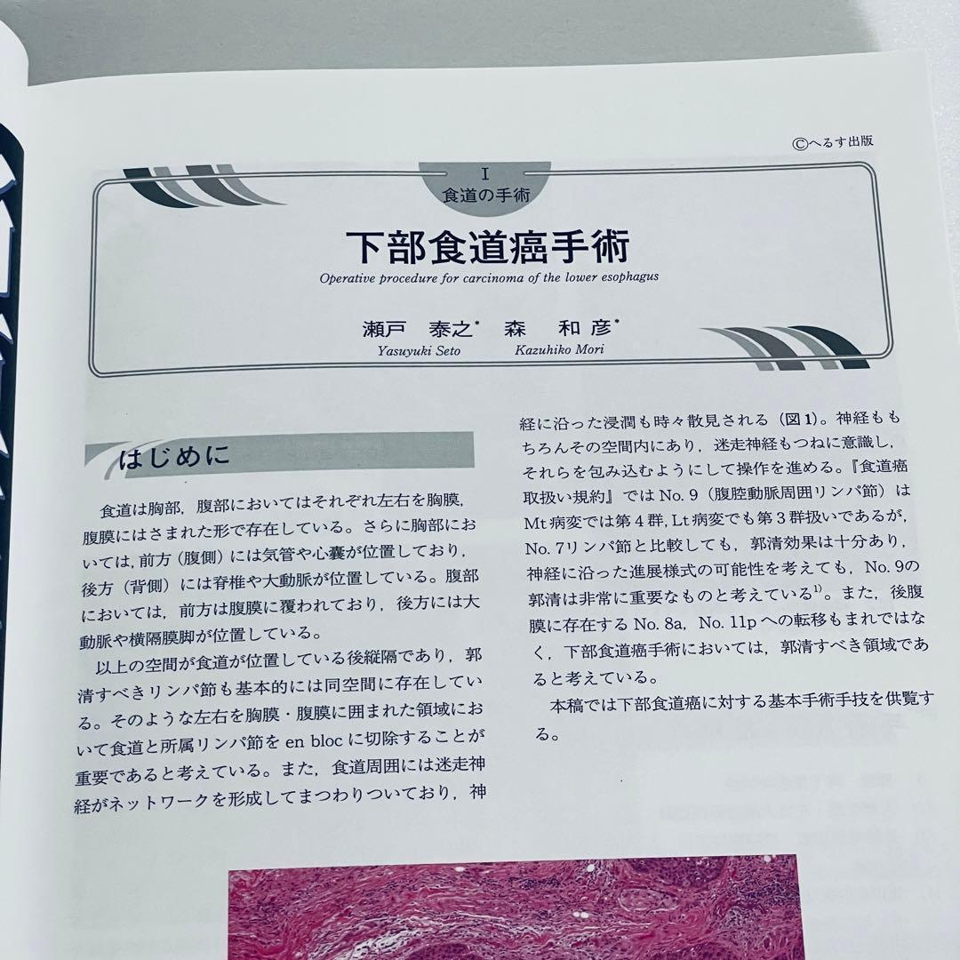 消化器外科　2011年5月号　アトラスで学ぶ達人の手術　臨時増刊号