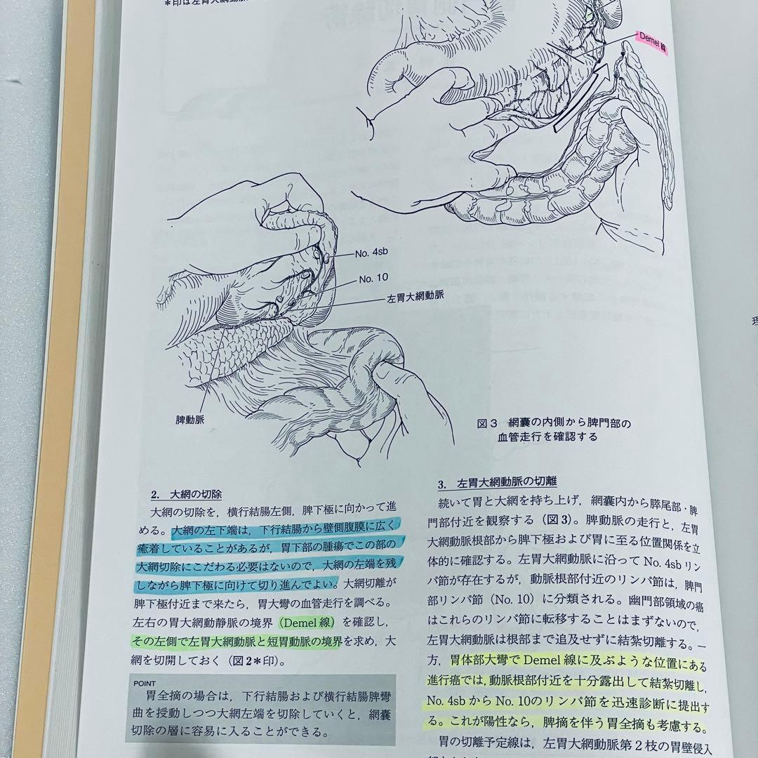 消化器外科　2011年5月号　アトラスで学ぶ達人の手術　臨時増刊号