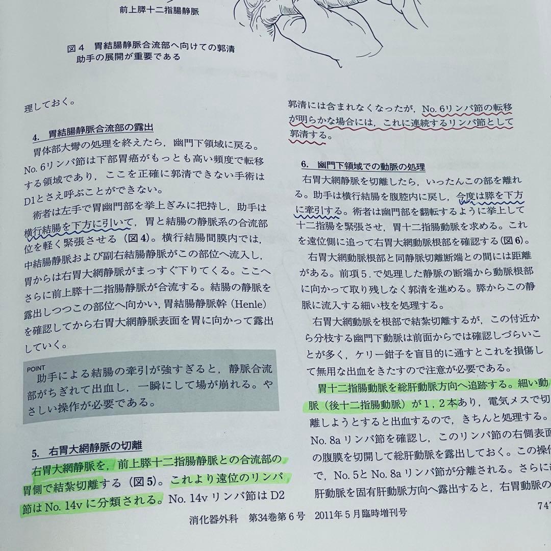 消化器外科　2011年5月号　アトラスで学ぶ達人の手術　臨時増刊号
