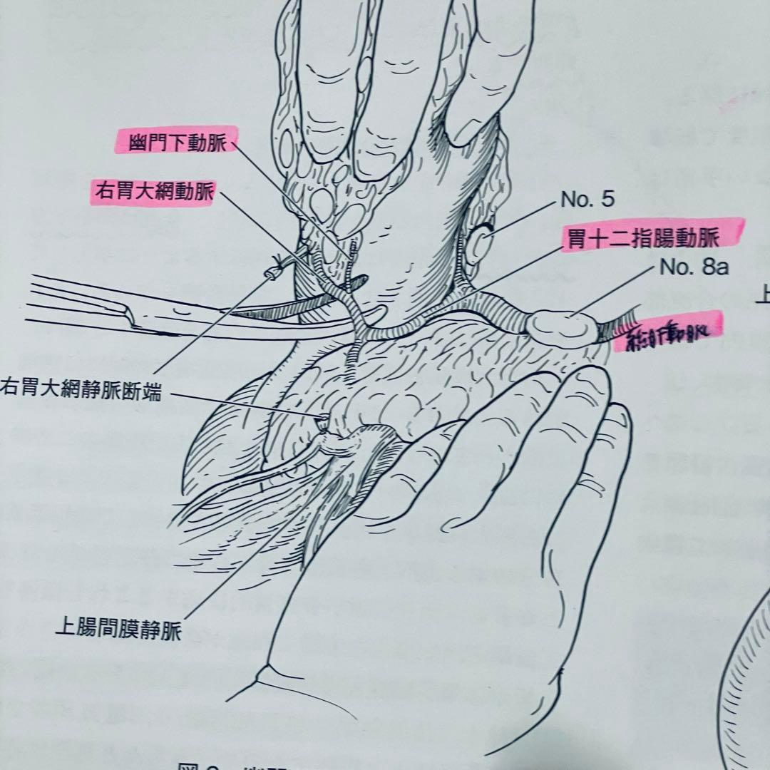 消化器外科　2011年5月号　アトラスで学ぶ達人の手術　臨時増刊号