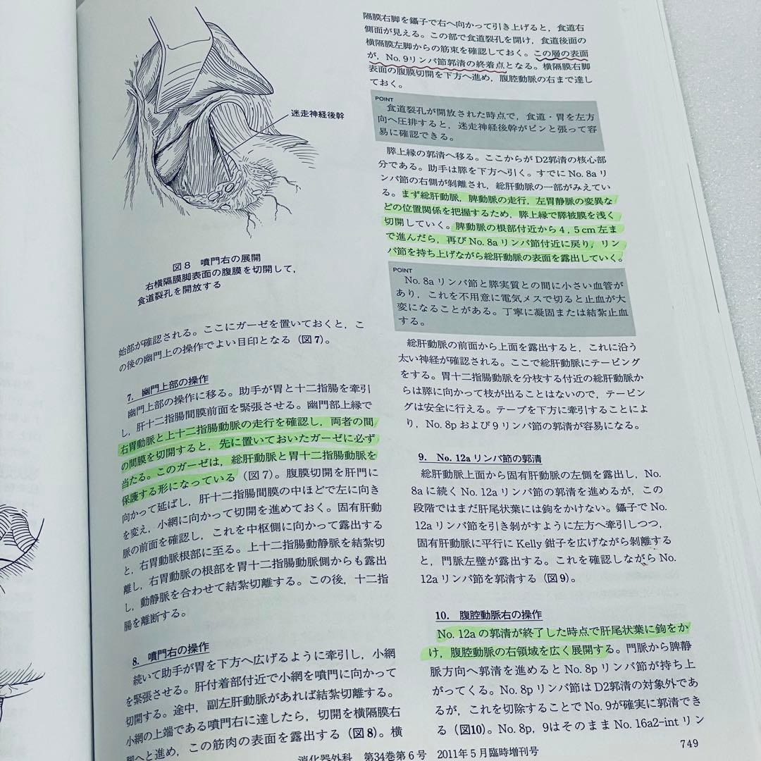 消化器外科　2011年5月号　アトラスで学ぶ達人の手術　臨時増刊号