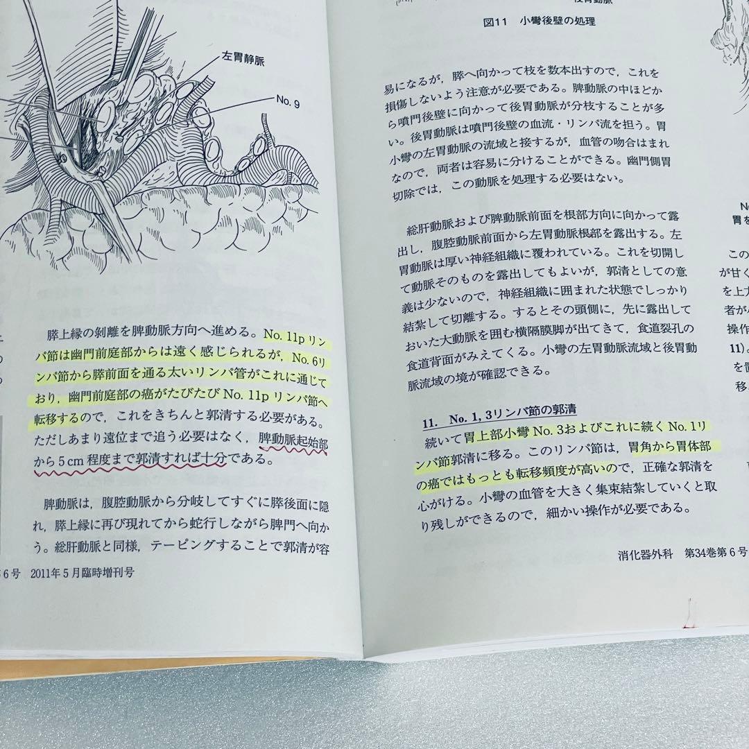 消化器外科　2011年5月号　アトラスで学ぶ達人の手術　臨時増刊号