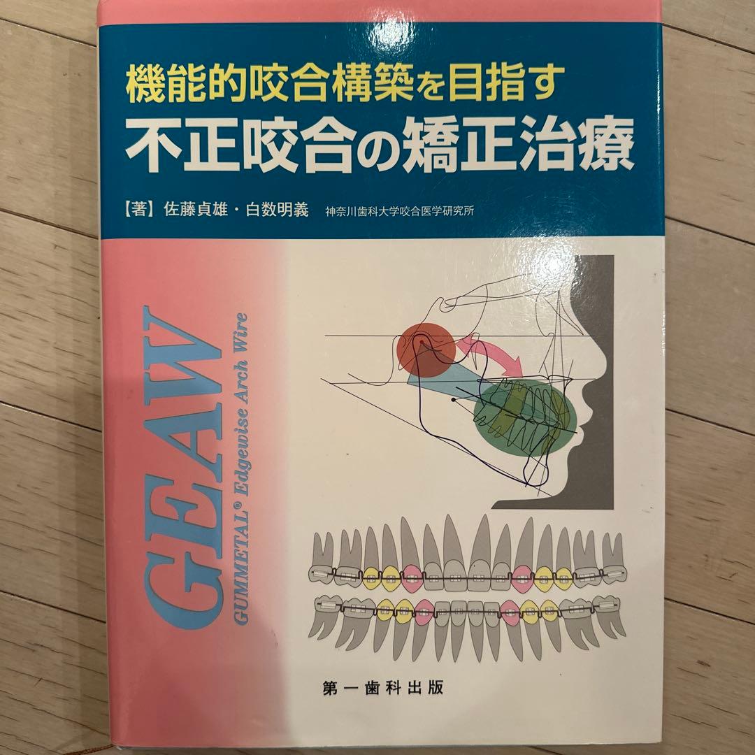 不正咬合の矯正治療