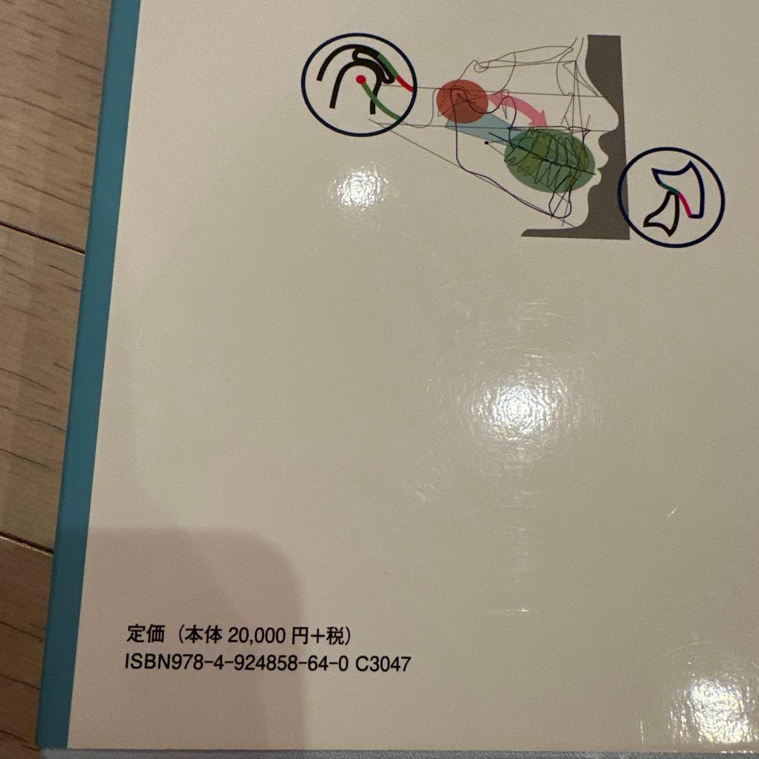 不正咬合の矯正治療