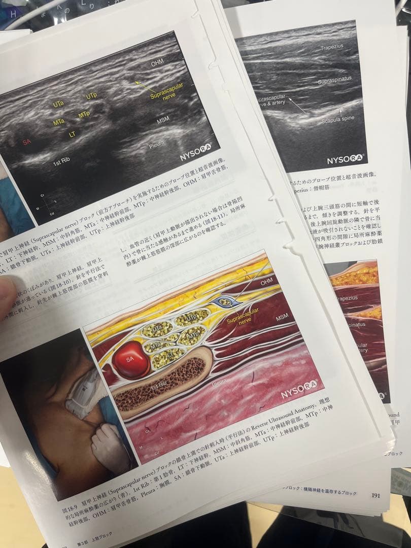 Hadzic's 超音波ガイド下末梢神経ブロックと解剖