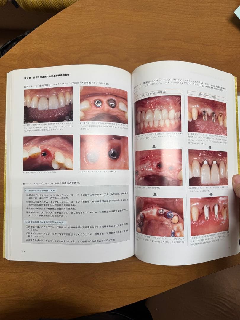 前歯部審美修復 インプラント編　小濵忠一著