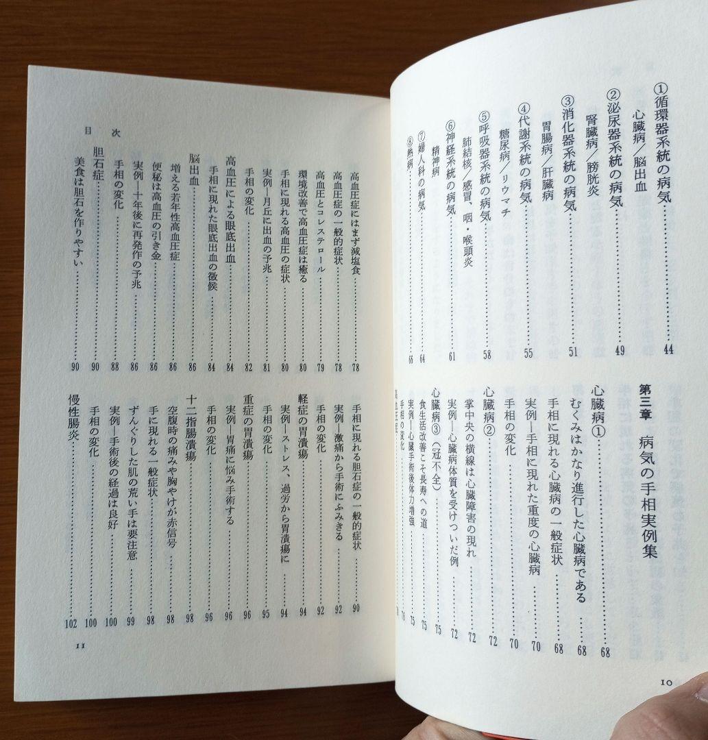 手相で病気を早期発見―患者の手形で実証した