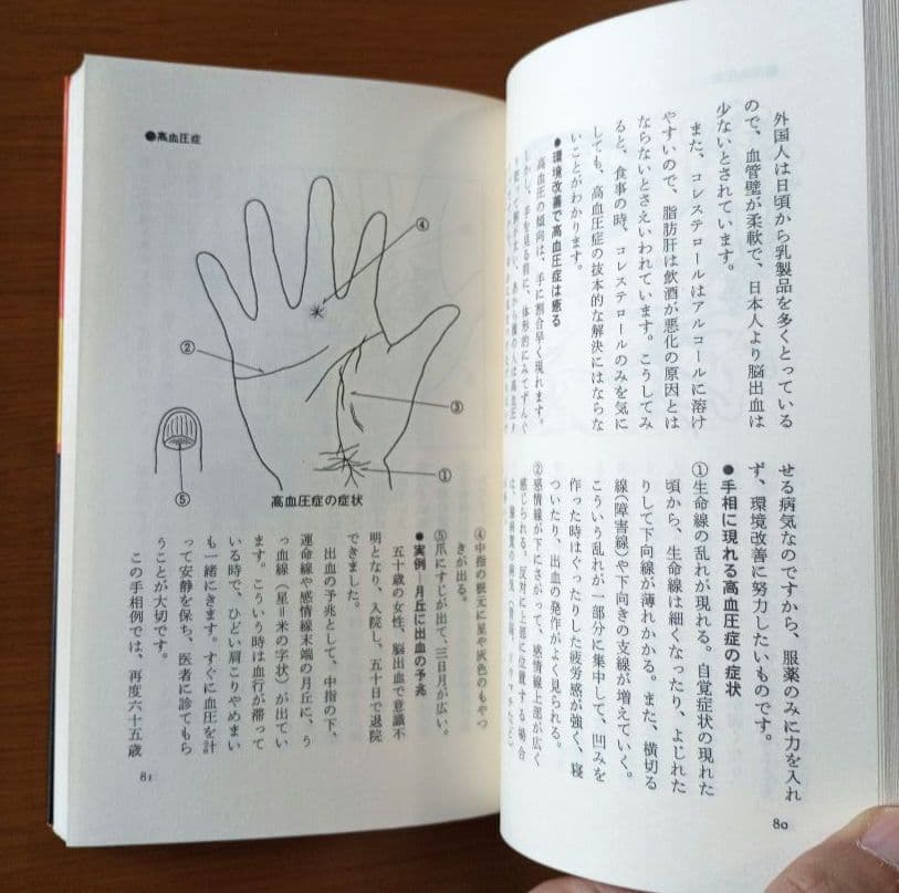 手相で病気を早期発見―患者の手形で実証した