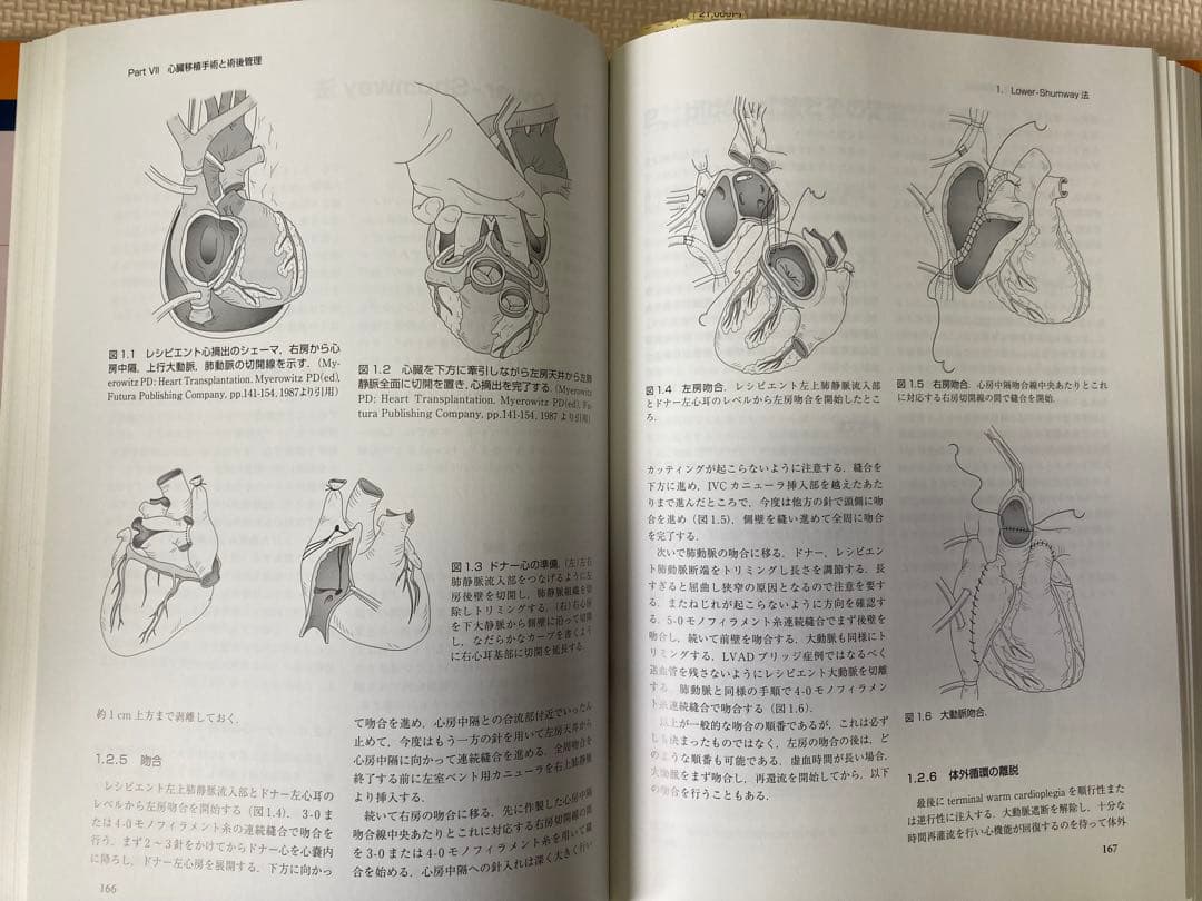 【書込み・裁断なし】心臓移植