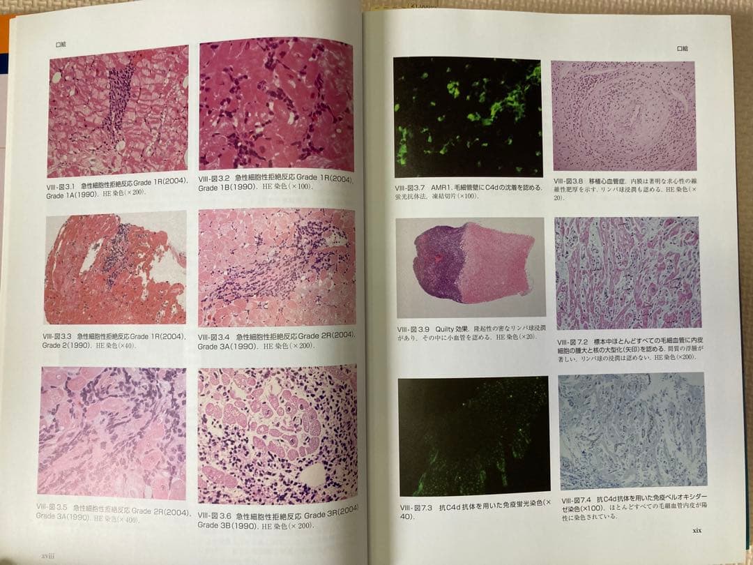 【書込み・裁断なし】心臓移植