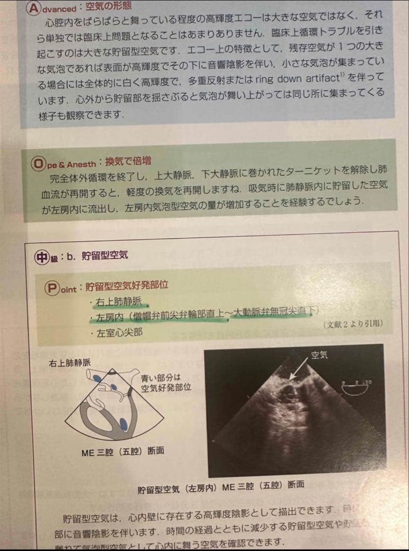 初心者から研修医のための経食道心エコー Ⅱ 2 （裁断済み）