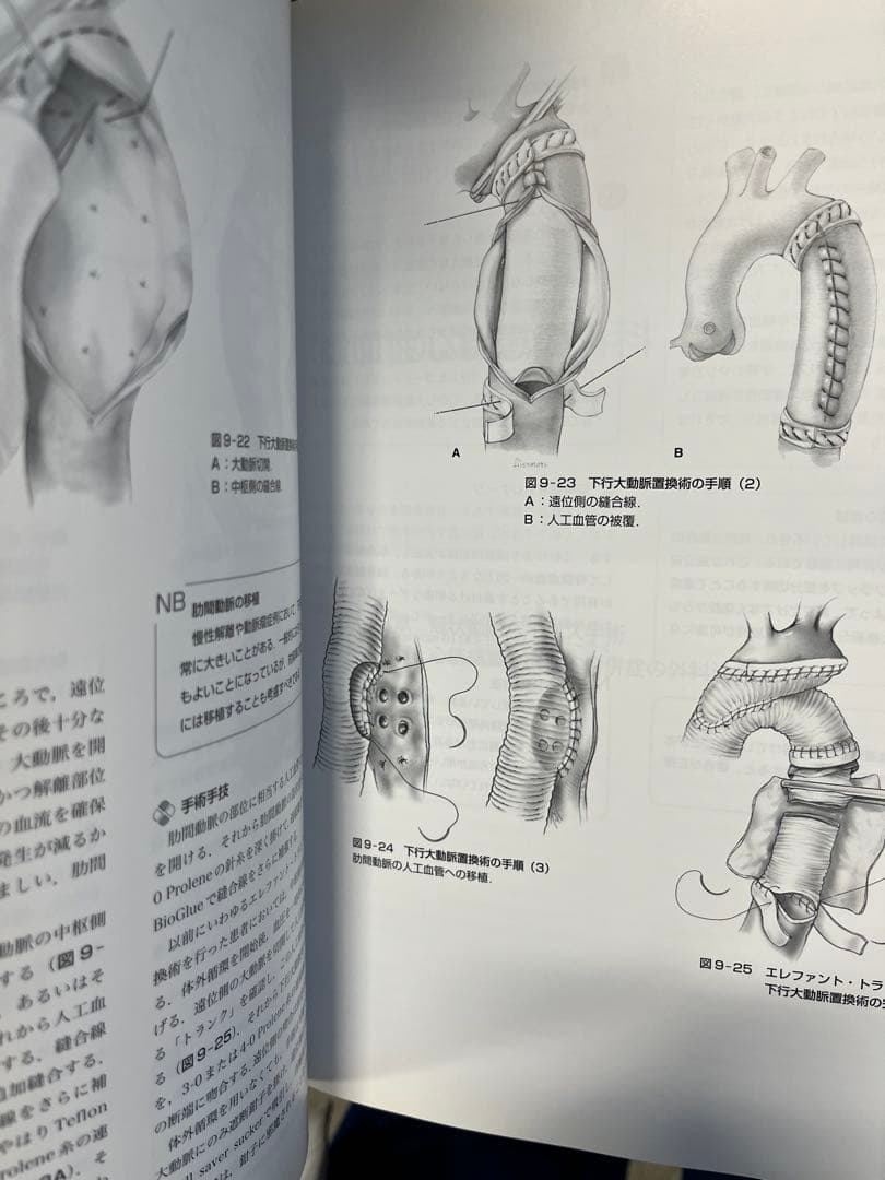 セーフティテクニック 心臓手術アトラス 原書第3版