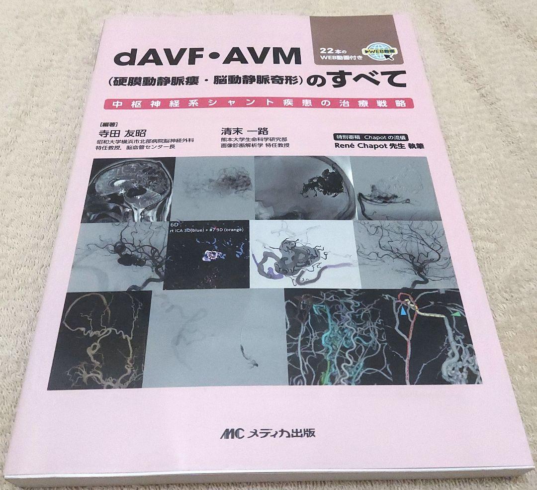 dAVF・AVM(硬膜動静脈瘻・脳動静脈奇形)のすべて : 中枢神経系シャント…