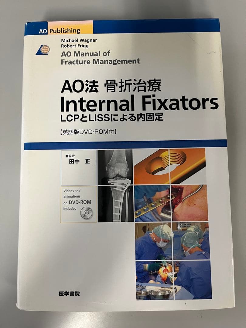 AO法 骨折治療 Internal Fixators