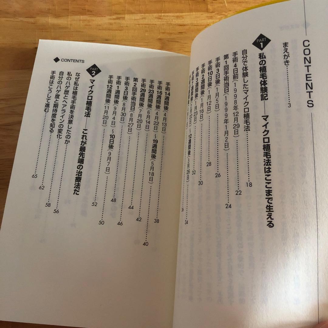 Dr.今川の植毛体験記 専門医が自分の髪で実践したドキュメント 最先端の自毛植…