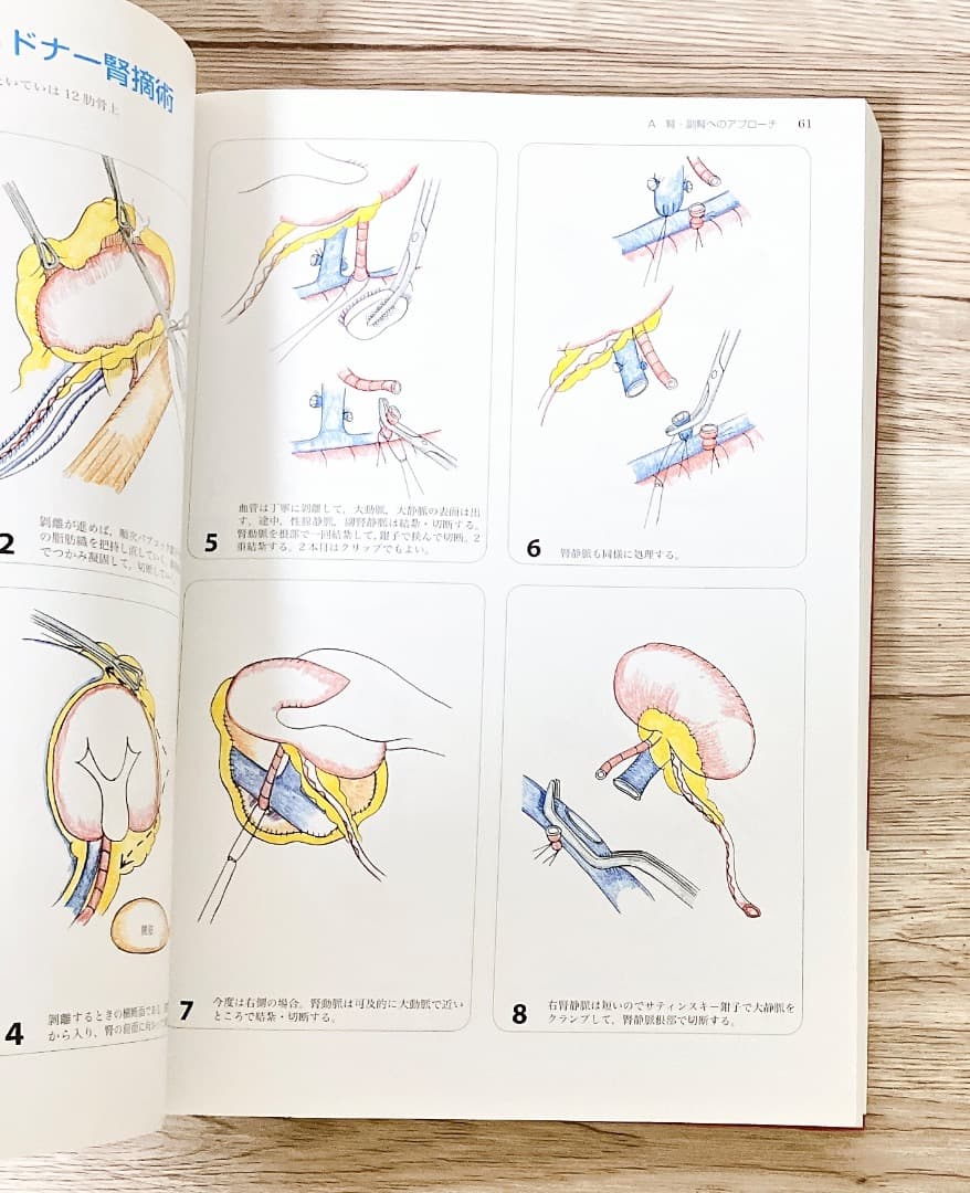 イラストレイテッド泌尿器科手術 図脳で覚える術式とチェックポイント 加藤 晴朗