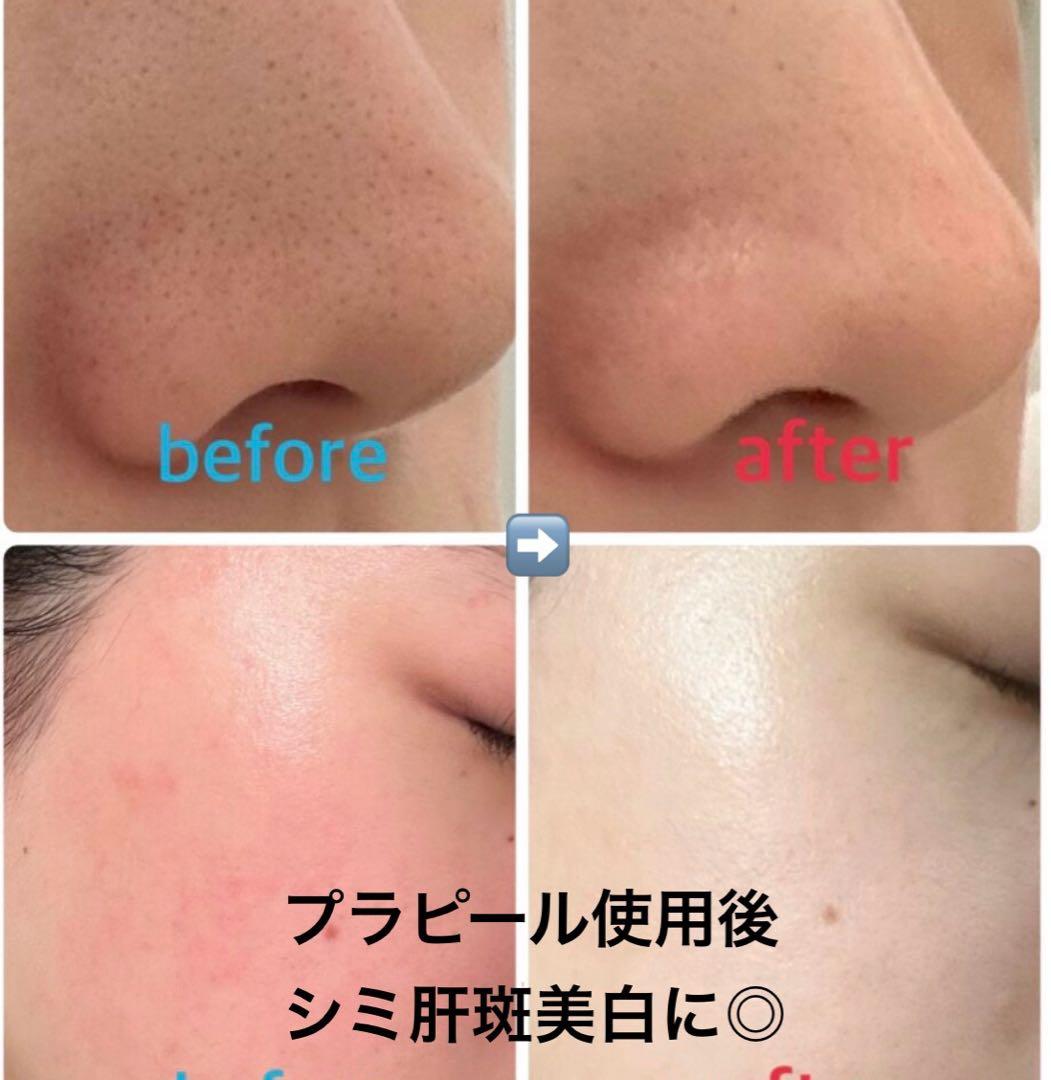 ララピールの新体制☆サロン専売品プラピールお得に6回分9,900円