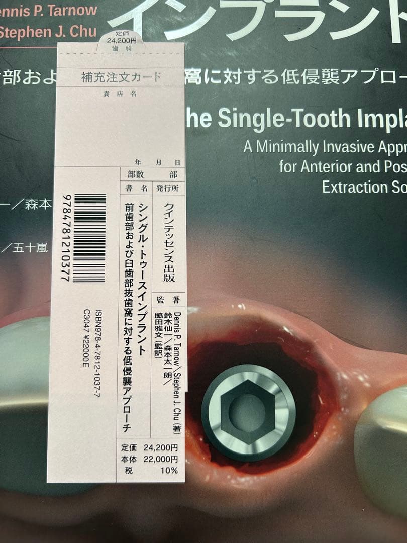 シングル・トゥース インプラント