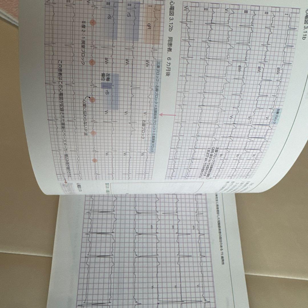 ER心電図の超速診断 カラー 救急現場で初心者から役立つ