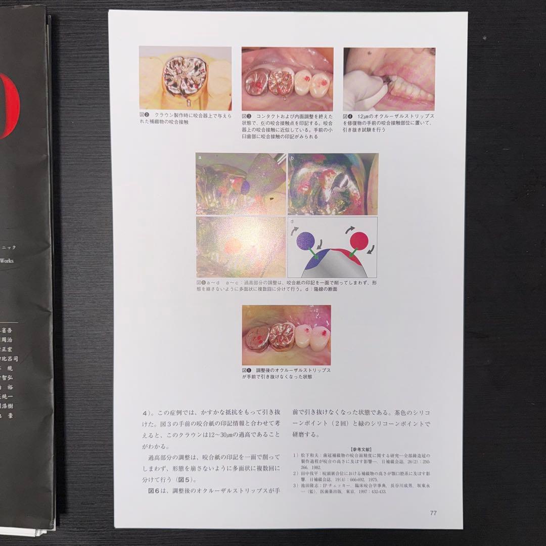 聞くに聞けない補綴治療100