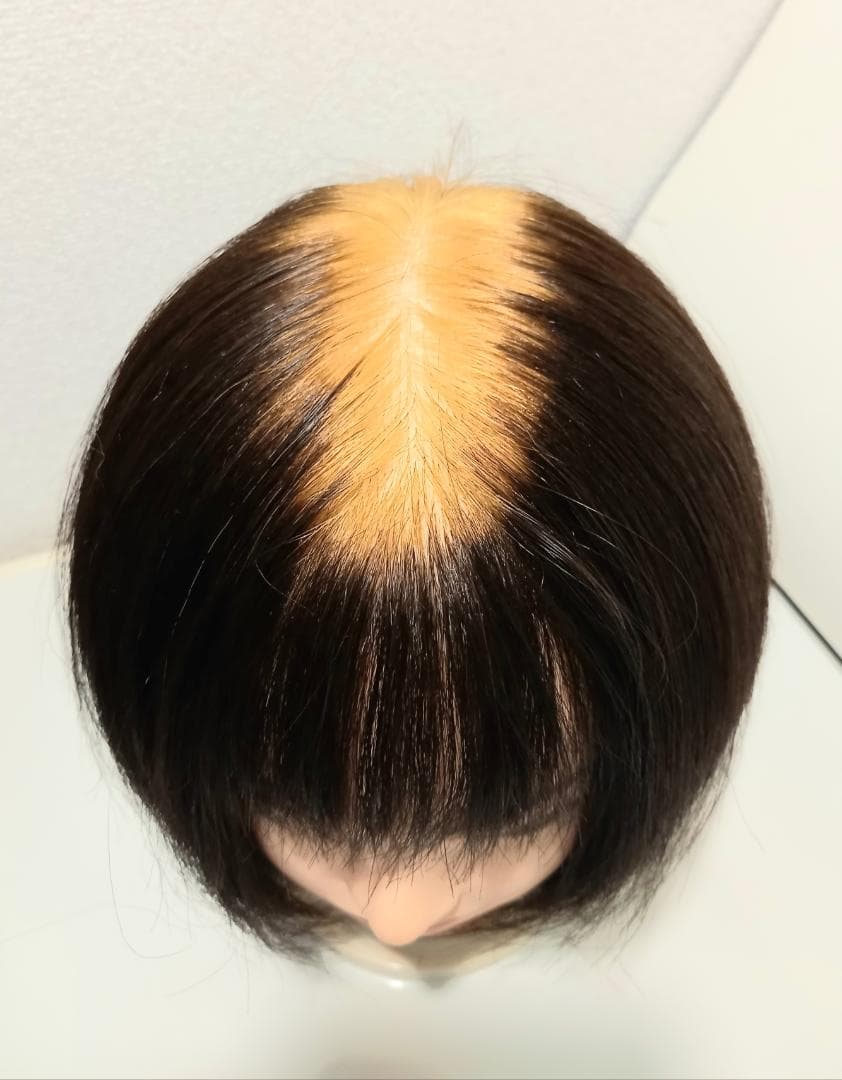 トップピース　つむじ分け目ピース