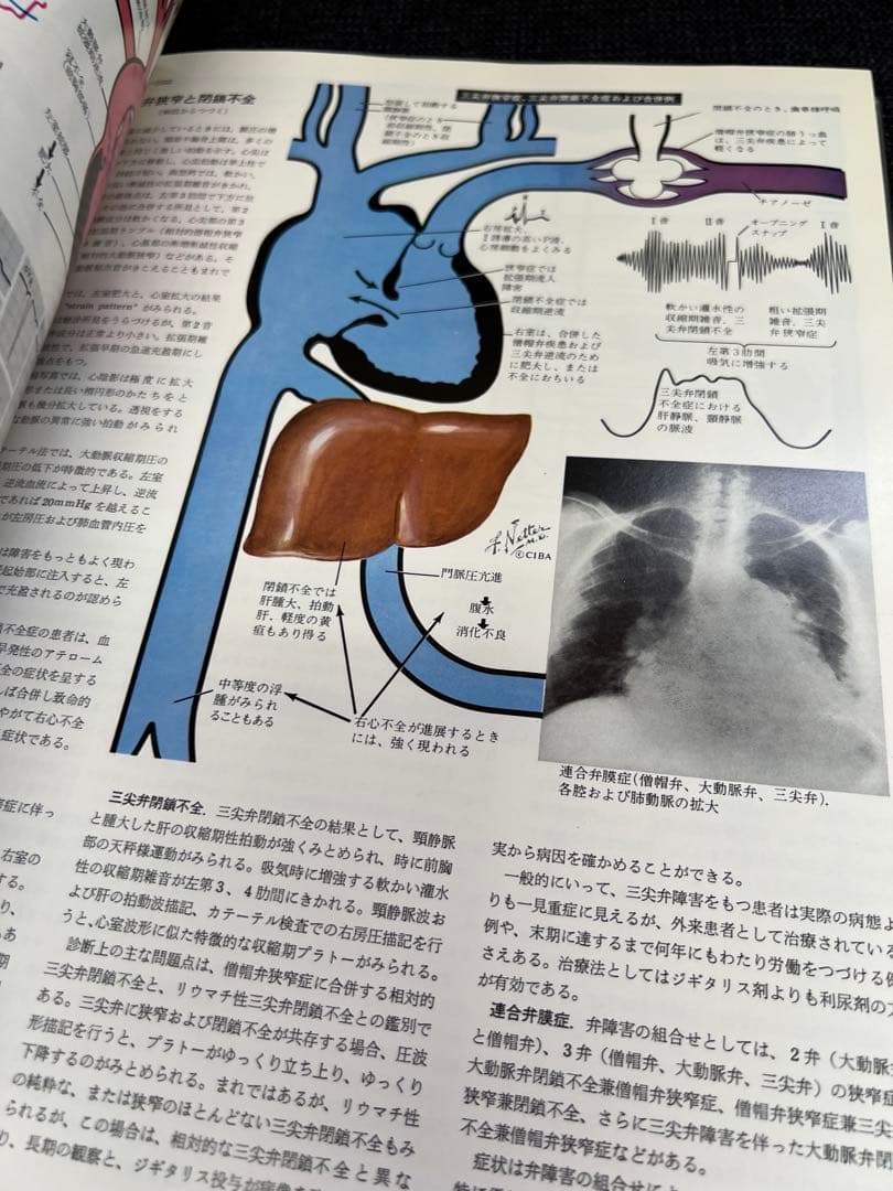 医学図譜集 心臓編【Frank H. Netter】解剖学専門書 医学イラスト本