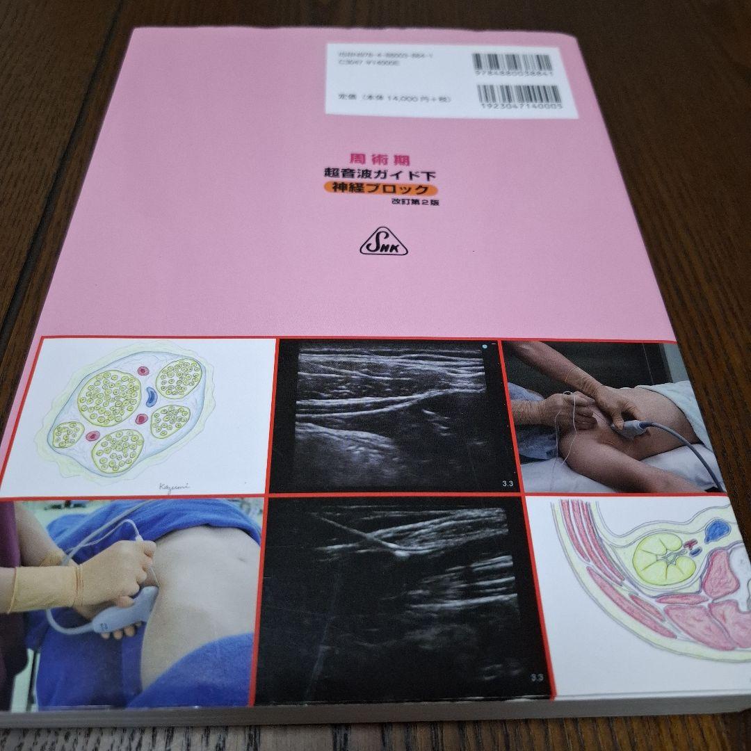 周術期超音波ガイド下神経ブロック